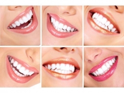 Комплексная чистка зубов с AirFlow или без, с ультразвуком, полировкой и минерализующим покрытием в стоматологической клинике «Альбус» со скидкой до 66%